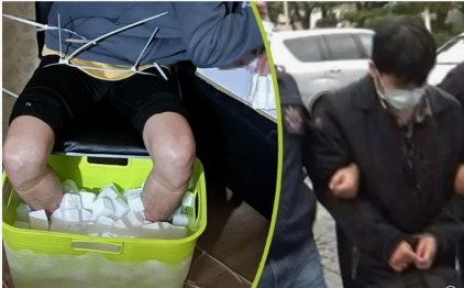 Жадность фраера сгубила: Студент поплатился ногами за обман страховой компании.