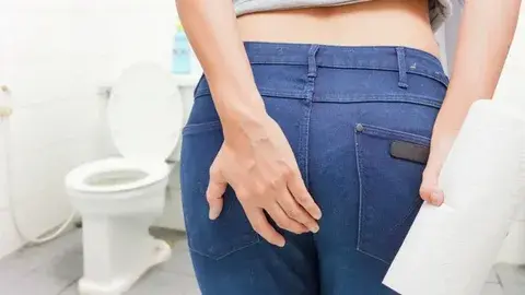 🟩Как лечить геморой в домашних условиях. Народная медицина