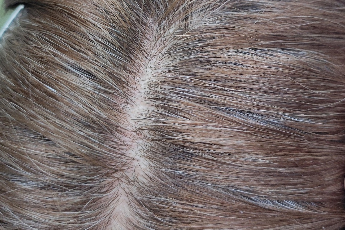 Решила отращивать волосы с сединой и не травить себя аммиачными красками: мой путь, часть 1