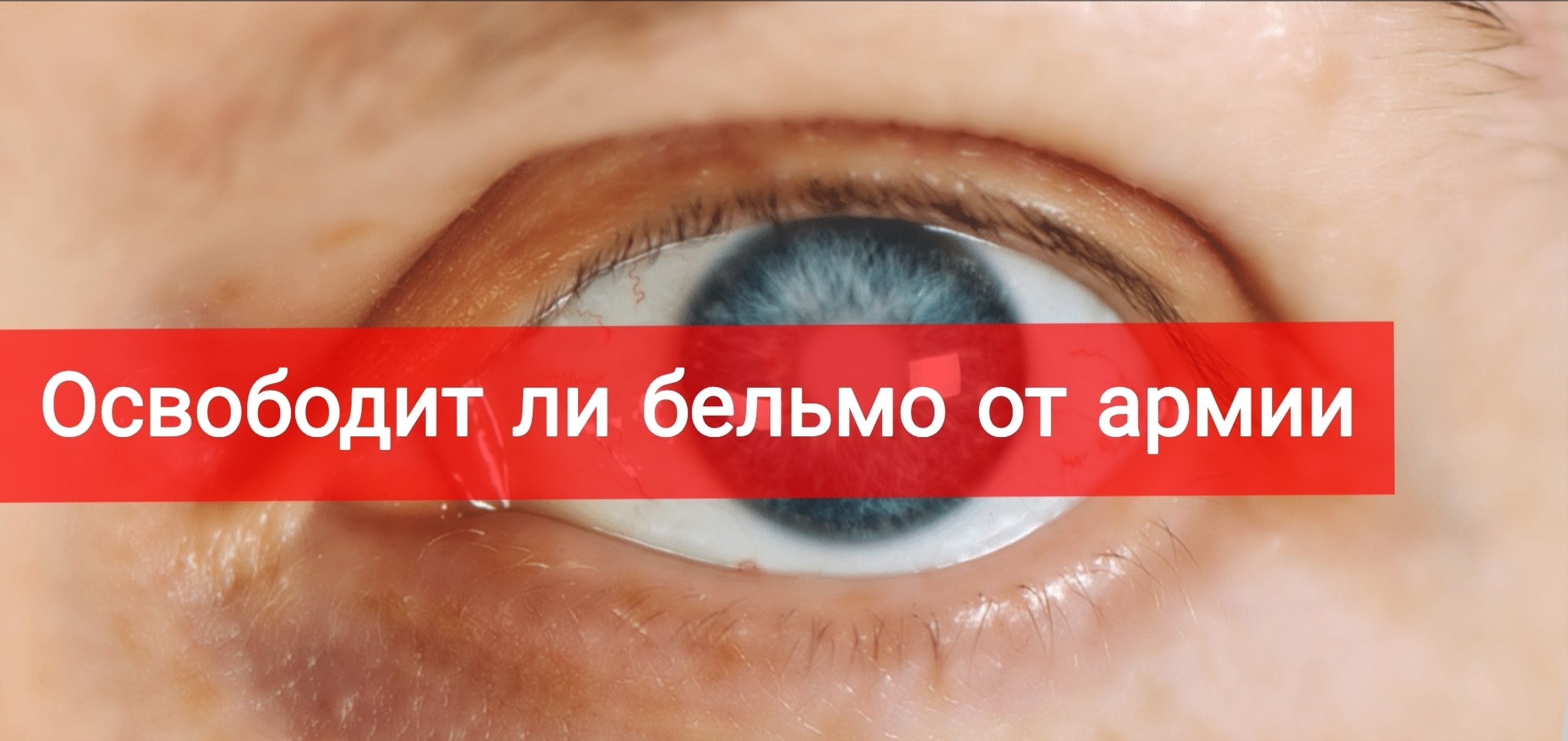 Освободит ли бельмо от армии