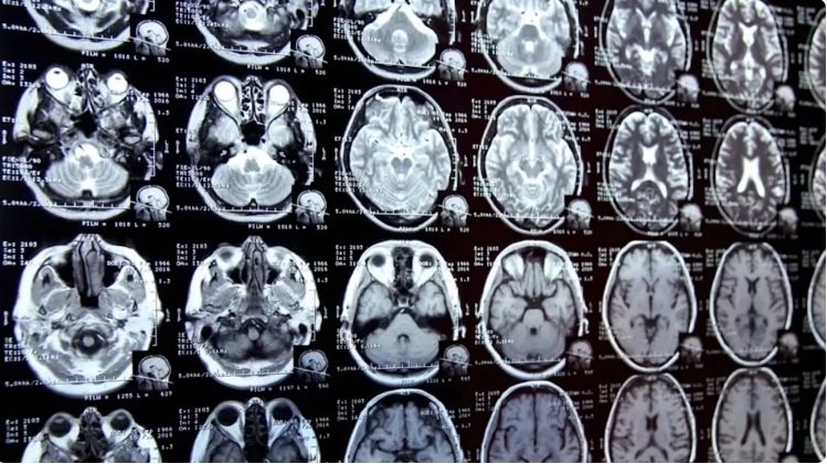 Психиатр бьет тревогу после опасного открытия, сделанного в области изучения человеческого мозга.
