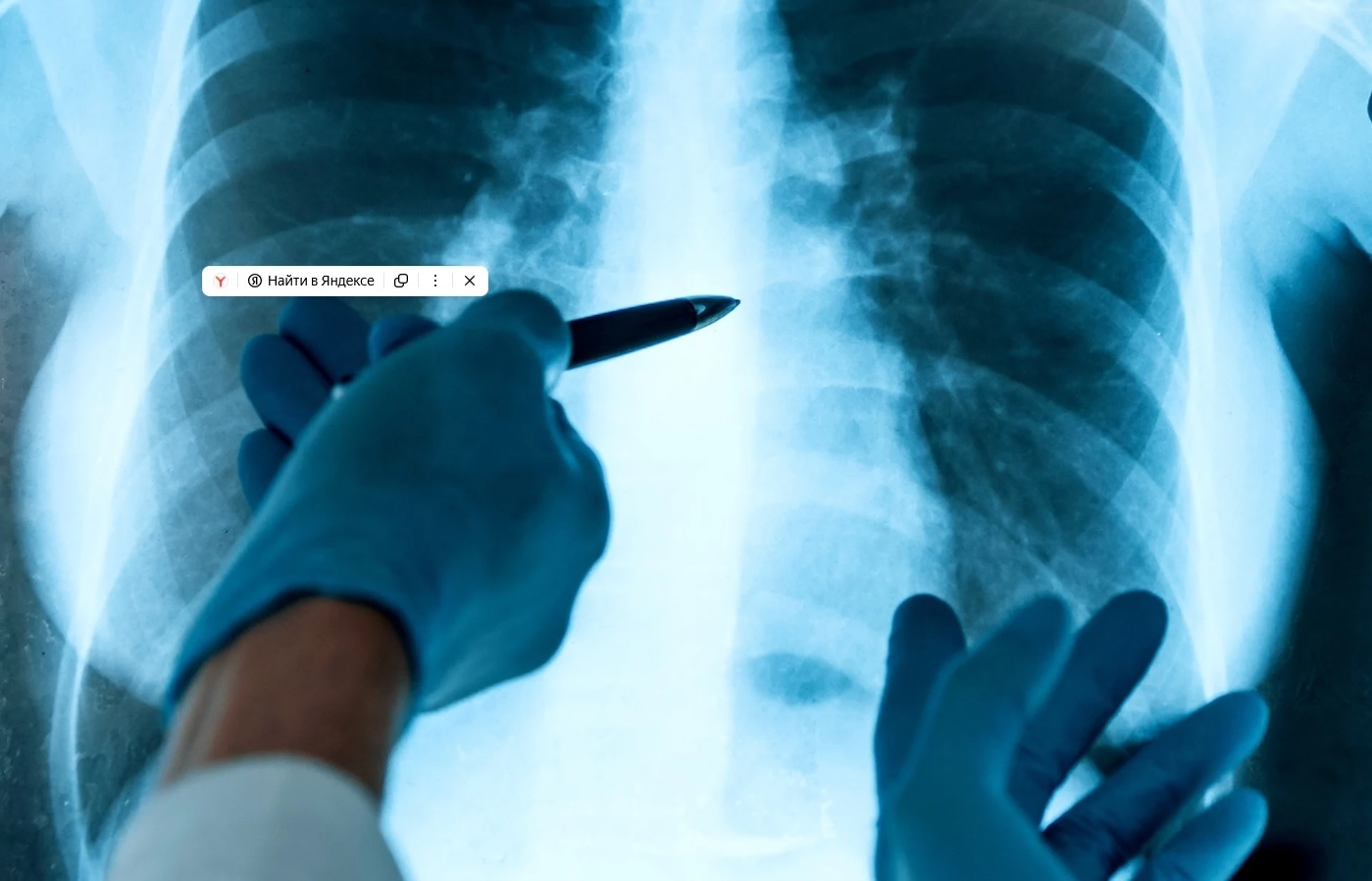 Ученые обеспокоены «неожиданным» открытием, сделанным в глубине легких каждого живого человека: «Мы не ожидали найти [это]»