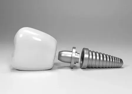 Взыскание денег за некачественный имплант