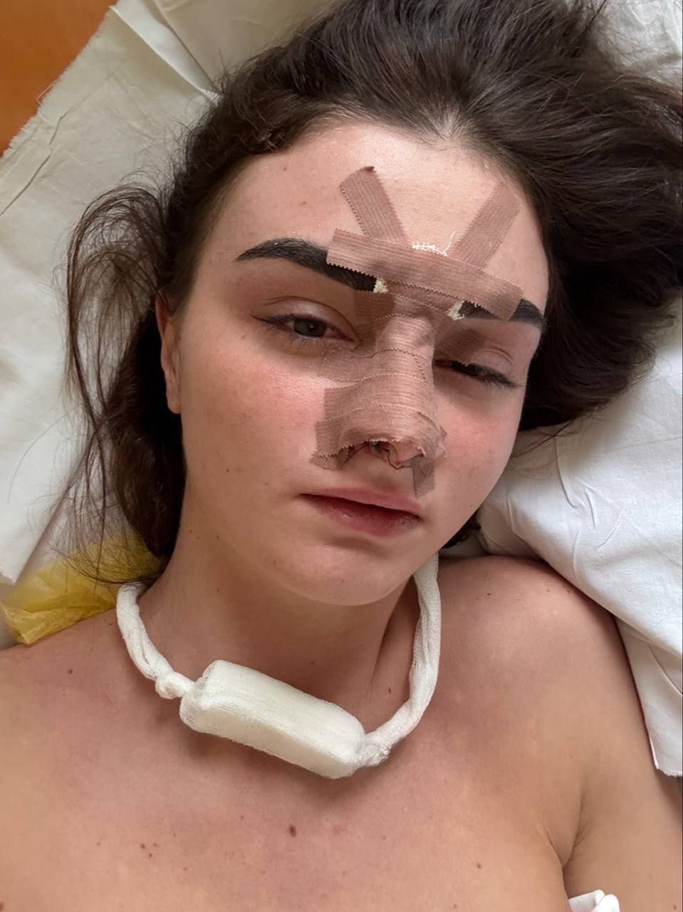 Омский ММАшник сломал жене нос из-за грязной раковины