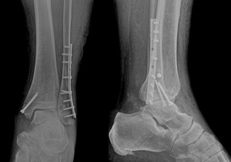 «Благодарный» пациент, или «Свинья под Дубом».
