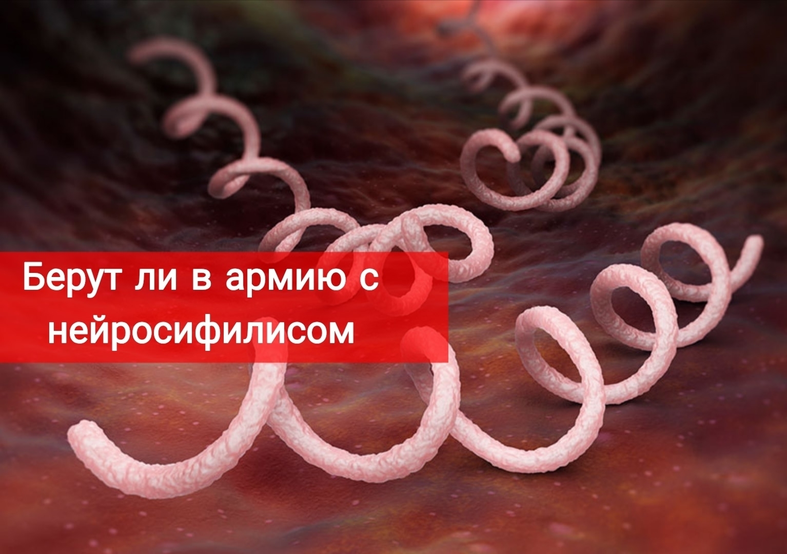 Берут ли в армию с нейросифилисом