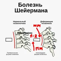 Шейерман.JPG