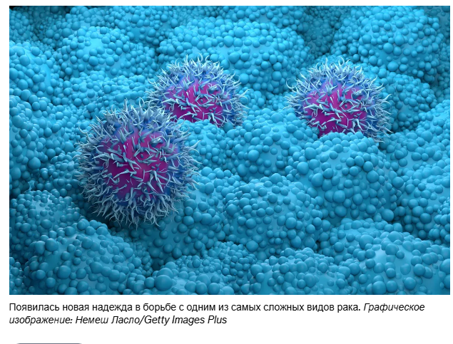 Наконец-то реальный прогресс в борьбе с раком поджелудочной железы.