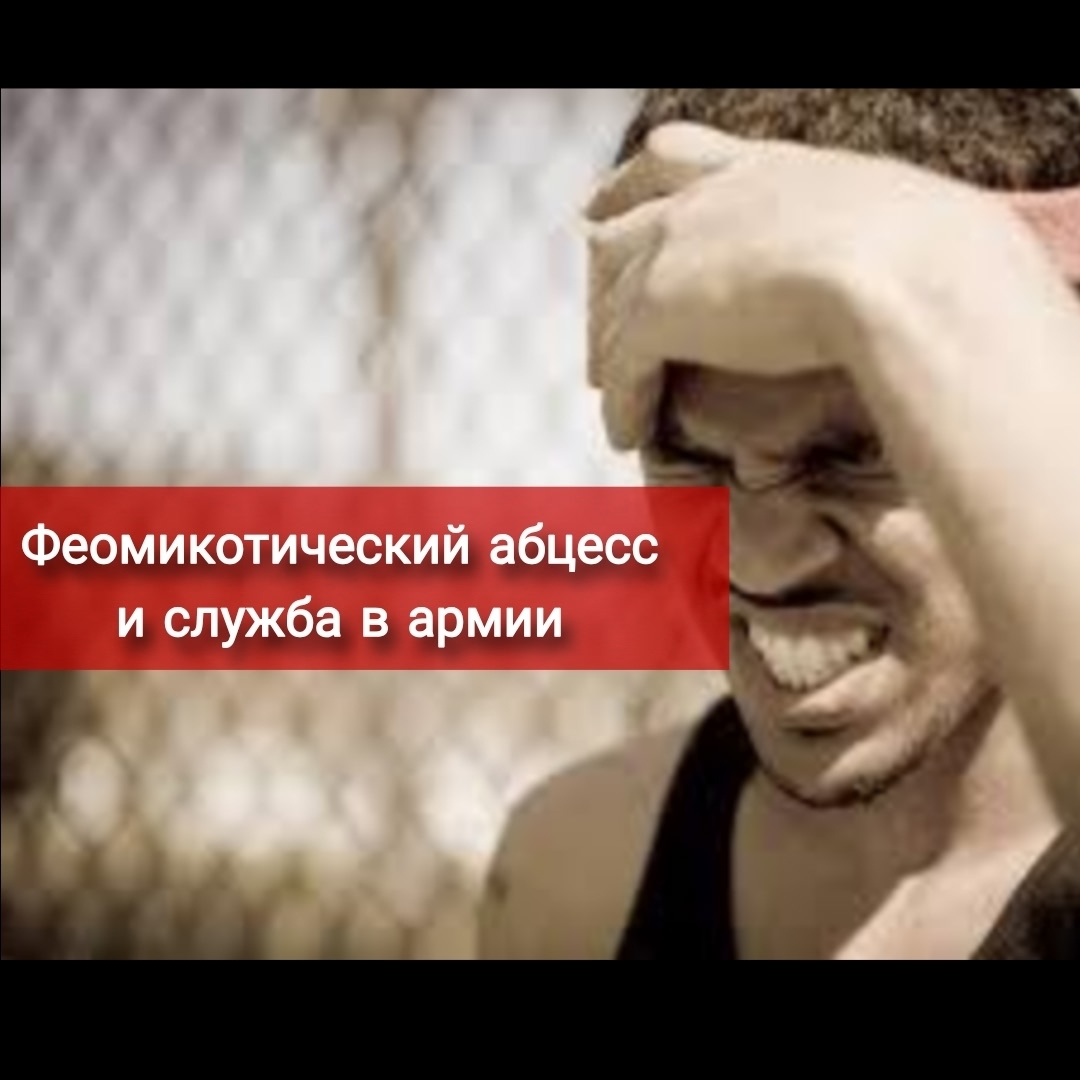 Феомикотический абсцесс и служба в армии