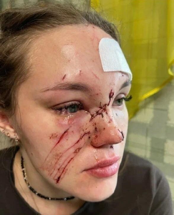 В кировском ночном клубе медсестра "розочкой" изуродовала молодую учительницу
